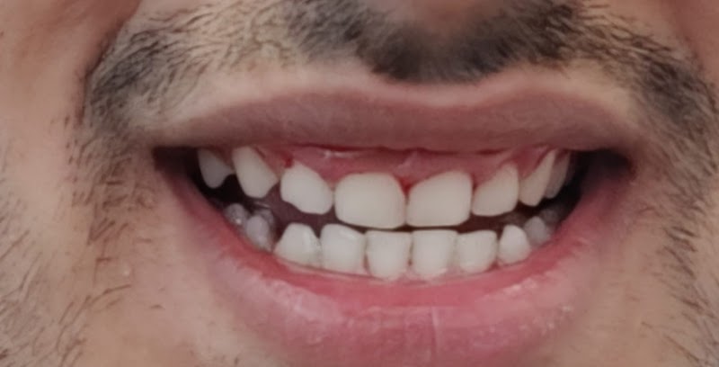 Kingshurst Dental Surgery - photo 1