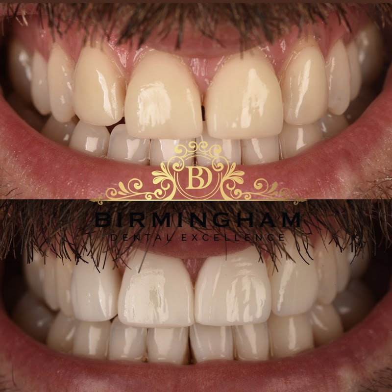 BIRMINGHAM DENTAL EXCELLENCE - photo 1